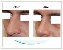 Slider image (3) Aesthetic Cosmetic Plastic Surgery Center Bolivia - SensualBodyDream